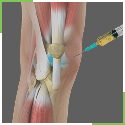 Procedures Image